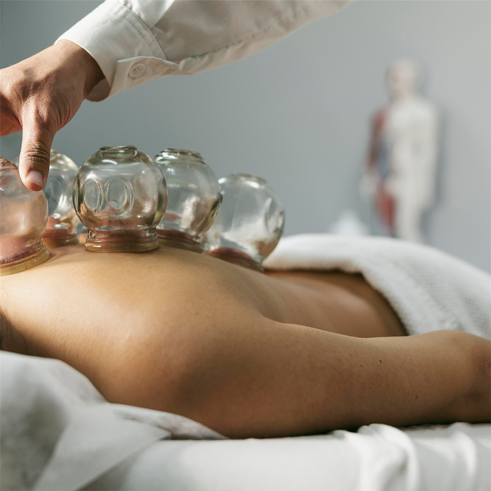 Cupping Therapy